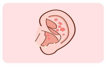 爱耳日幼儿园活动方案优质7篇